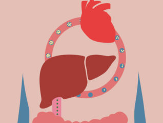 Hiding in plain sight: HDL dysfunction